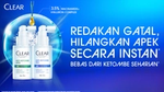 Teknologi ScalpPro Tech™ mutakhir dari CLEAR